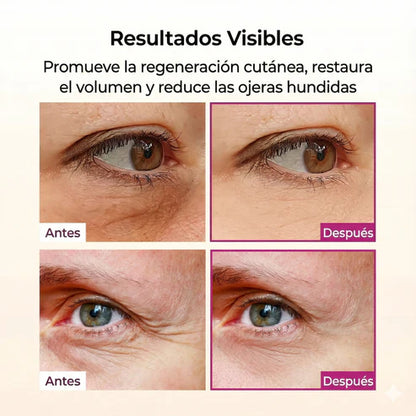 Bálsamo Facial Reafirmante - Reduce Arrugas y Líneas de Expresión